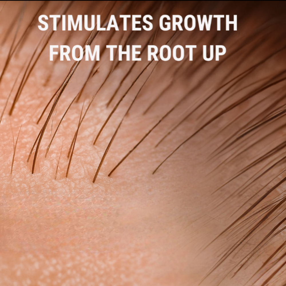 RootRise - Hair Growth Gummies
